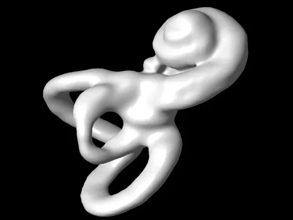 3T MRI 2