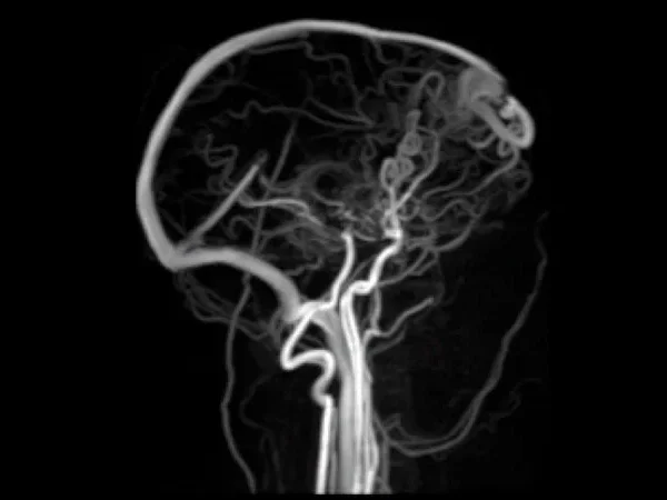 3T MRI 3