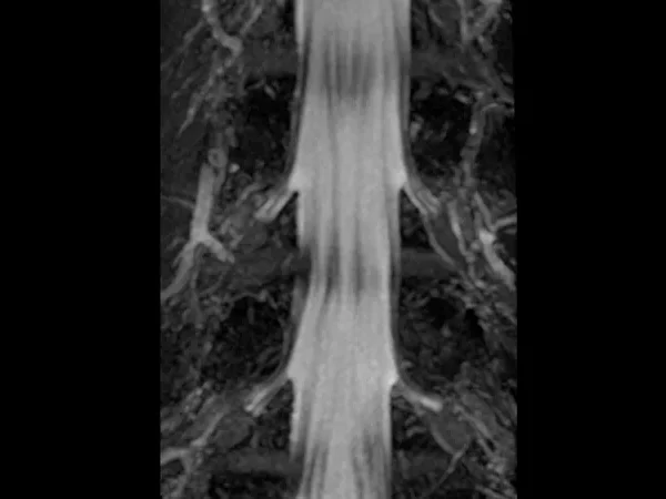 3T MRI 4