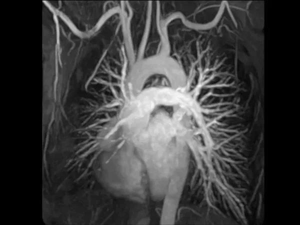 3T MRI 6