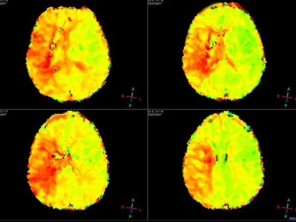 3T MRI 8