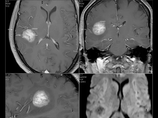 3T MRI 9