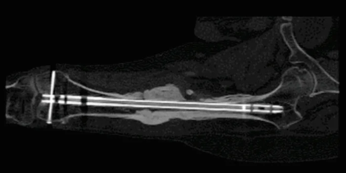 CT Scan 7