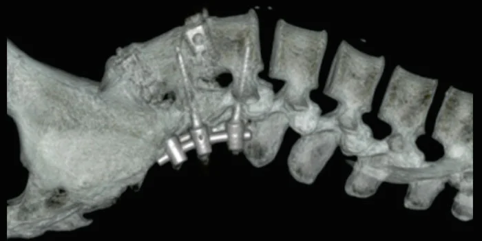 CT Scan 8