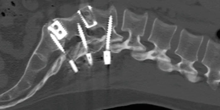 CT Scan 9
