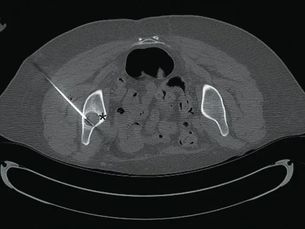 Interventional Radiology 3
