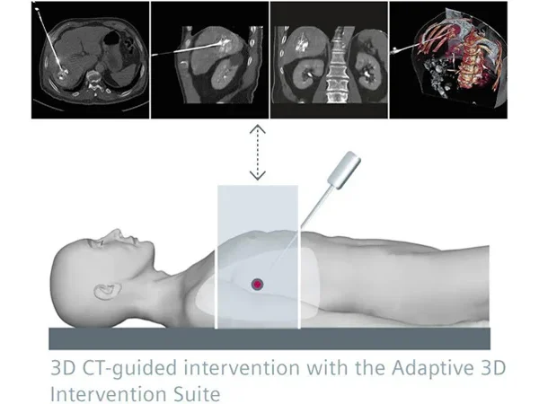 Interventional Radiology 4