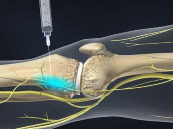 Interventional Radiology 5