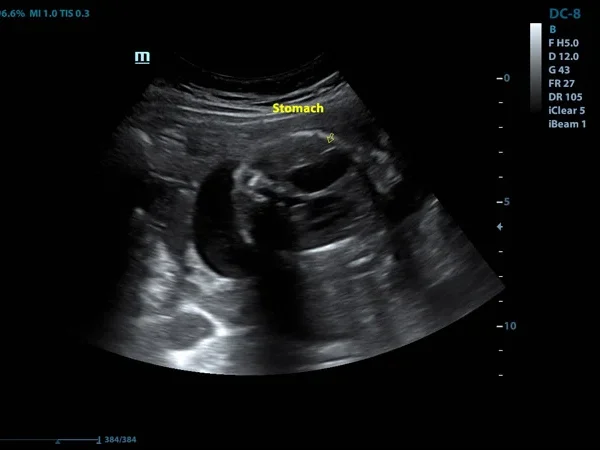 Ultrasound(USG) 8