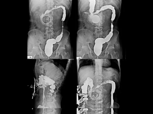 Contrast Procedures 3