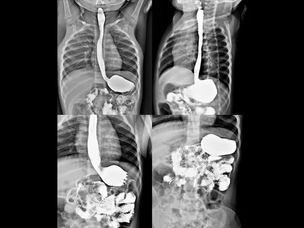 Contrast Procedures 4