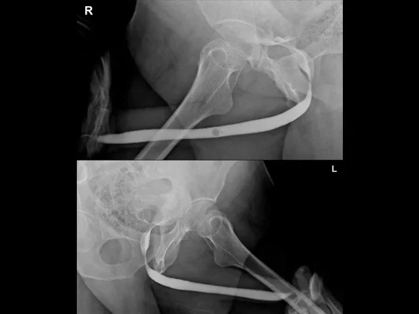 Contrast Procedures 5