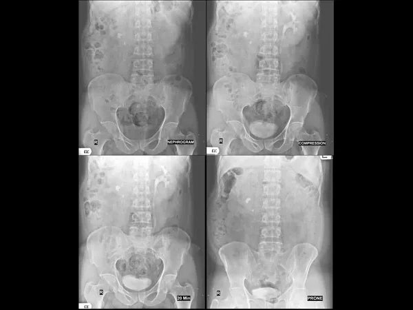 Contrast Procedures 6