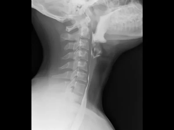 Contrast Procedures 8
