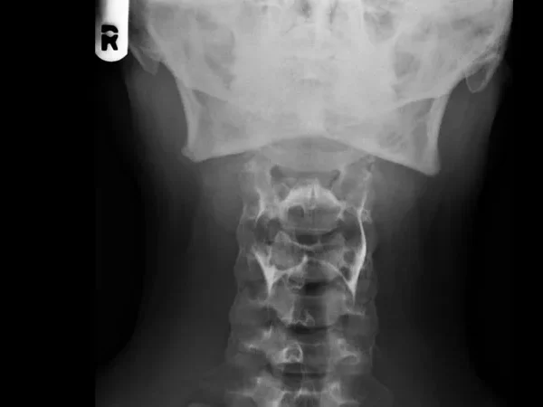 Digital X-ray 2