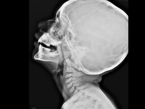 Digital X-ray 3