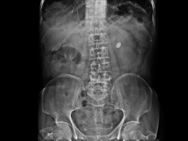 Digital X-ray 4